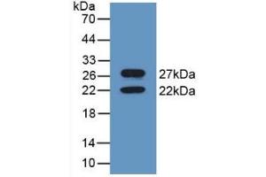 Detection of Recombinant CNX, Mouse using Polyclonal Antibody to Calnexin (CNX)