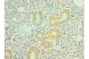 Immunohistochemistry of paraffin-embedded human pancreatic tissue using ABIN7162721 at dilution of 1:100 (PDLIM1 Antikörper  (AA 1-329))