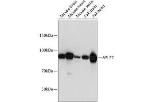 Western blot analysis of extracts of various cell lines, using  Polyclonal Antibody (ABIN6129925, ABIN6136995, ABIN6136996 and ABIN6221112) at 1:1000 dilution. (APLP2 Antikörper  (AA 340-450))