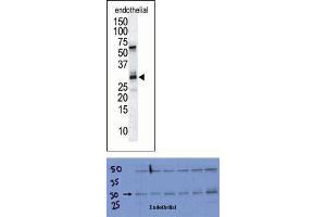TOP: The anti-DSCR1 Pab is used in Western blot to detect DSCR1 in endothelial tissue lysate. (RCAN1 Antikörper  (C-Term))