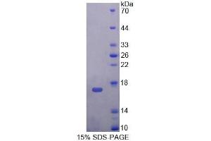 SDS-PAGE analysis of Mouse TNP2 Protein. (TNP2 Protein)