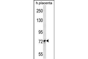 Western blot analysis in human placenta tissue lysates (35ug/lane). (SCYL1 Antikörper  (N-Term))