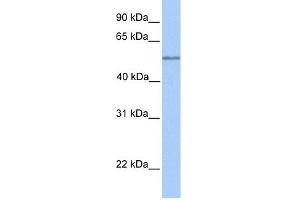 WB Suggested Anti-C17orf74 Antibody Titration: 0. (C17orf74 Antikörper  (Middle Region))