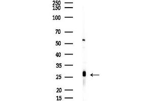anti-SRY (Sex Determining Region Y)-Box 14 (SOX14) (Internal Region) antibody
