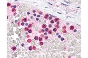 Anti-TLR4 antibody IHC of human neutrophils.