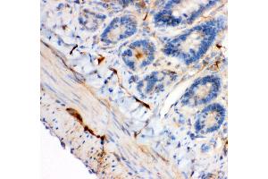 Anti- IRS1 antibody, IHC(P) IHC(P): Rat Intestine Tissue (IRS1 Antikörper  (AA 1041-1242))