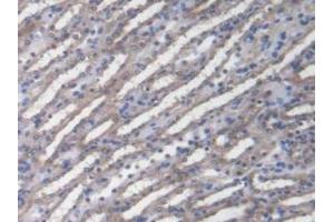 Figure. (DNAJC2 Antikörper  (AA 368-621))