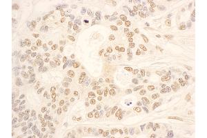 anti-NOP58 Ribonucleoprotein (NOP58) (AA 479-529) antibody