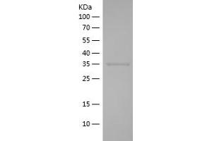 Western Blotting (WB) image for Apurinic/Apyrimidinic Endonuclease 1 (APEX1) (AA 97-195) protein (His-IF2DI Tag) (ABIN7121878) (APEX1 Protein (AA 97-195) (His-IF2DI Tag))