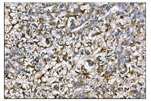 IHC analysis of MERTK using anti-MERTK antibody (ABIN7600623). (MERTK Antikörper  (AA 21-489))