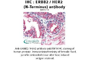 Image no. 1 for anti-Receptor tyrosine-protein kinase erbB-2 (ErbB2/Her2) (Extracellular Domain), (N-Term) antibody (ABIN1734114) (ErbB2/Her2 Antikörper  (Extracellular Domain, N-Term))
