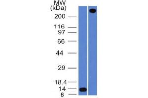 Western Blot Analysis A) Recombinant Protein (B) human lung lysate Using VWF Mouse Monoclonal Antibody (VWF/1465).