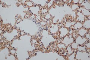 Immunohistochemistry (IHC) image for anti-Natural Killer Cell Receptor 2B4 (CD244) antibody (ABIN5959143) (2B4 Antikörper)
