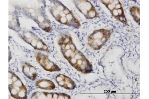 Immunoperoxidase of monoclonal antibody to CDC2 on formalin-fixed paraffin-embedded human small Intestine. (CDK1 Antikörper  (AA 1-297))