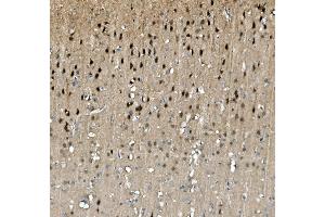 IHC analysis of TORC1/CRTC1 using anti-TORC1/CRTC1 antibody (ABIN7602801). (CRTC1 Antikörper  (C-Term))