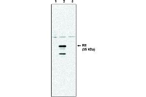 Western blot analysis using Rit antibody . (RIT1 Antikörper)