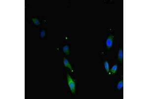 Immunofluorescent analysis of Hela cells using ABIN7171733 at dilution of 1:100 and Alexa Fluor 488-congugated AffiniPure Goat Anti-Rabbit IgG(H+L) (TRF2 Antikörper  (AA 78-238))