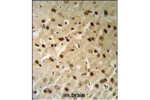 Immunohistochemistry (Paraffin-embedded Sections) (IHC (p)) image for anti-Beclin 1, Autophagy Related (BECN1) (AA 95-132) antibody (ABIN652595)