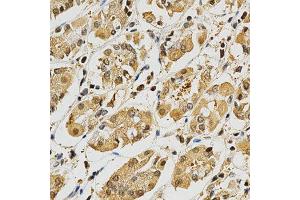 Immunohistochemistry of paraffin-embedded human stomach using PLK1 antibody at dilution of 1:200 (x400 lens) (PLK1 Antikörper  (AA 304-603))