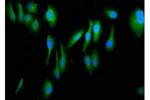 Immunofluorescence staining of Hela cells with ABIN7152698 at 1:266, counter-stained with DAPI. (FERMT1 Antikörper  (AA 321-420))