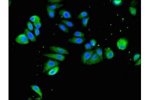 Immunofluorescent analysis of HepG2 cells using ABIN7171115 at dilution of 1:100 and Alexa Fluor 488-congugated AffiniPure Goat Anti-Rabbit IgG(H+L) (SLC18A2 Antikörper  (AA 463-514))