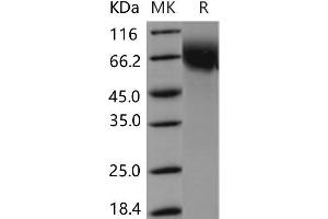Western Blotting (WB) image for CD6 (CD6) (Active) protein (His tag) (ABIN7194910) (CD6 Protein (CD6) (His tag))