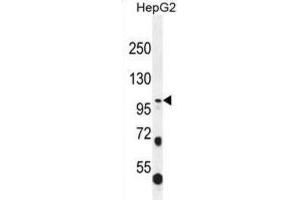 Western Blotting (WB) image for anti-Collagen, Type XXI, alpha 1 (COL21A1) antibody (ABIN2996551) (COL21A1 Antikörper)
