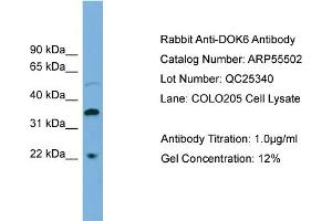 WB Suggested Anti-DOK6  Antibody Titration: 0. (DOK6 Antikörper  (Middle Region))