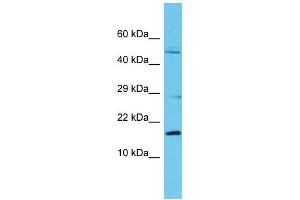 Host: Rabbit Target Name: C8orf44 Sample Type: Fetal Kidney lysates Antibody Dilution: 1. (C8ORF44 Antikörper  (N-Term))