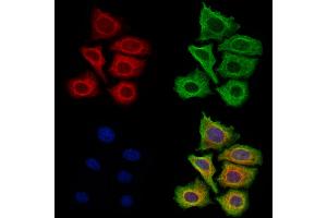 ABIN7094814 and ABIN7098865 staining Hela cells by IF/ICC. (Filaggrin Antikörper  (C-Term))