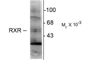Western blots of hippocampal lysate showing immunolabeling of the ~48k RXR-( isotype. (Retinoid X Receptor gamma Antikörper)