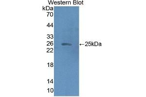 Detection of Recombinant HMGCS2, Human using Polyclonal Antibody to Hydroxymethylglutaryl Coenzyme A Synthase 2, Mitochondrial (HMGCS2) (HMGCS2 Antikörper  (AA 1-167))