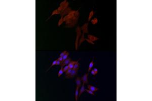 Immunofluorescence analysis of NIH/3T3 cells using  Rabbit pAb (ABIN3016805, ABIN3016806, ABIN3016807 and ABIN6219845) at dilution of 1:100. (ADAMTS5 Antikörper  (AA 731-930))