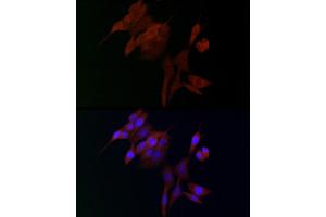 Immunofluorescence (IF) image for anti-ADAM Metallopeptidase with thrombospondin Type 1 Motif, 5 (ADAMTS5) (AA 731-930) antibody (ABIN3016806)