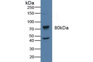 Figure. (beta-Adrenergic Receptor Kinase (AA 398-640) Antikörper)