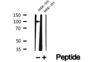 Western blot analysis of extracts of HEK-293, using CTNNA3 antibody. (CTNNA3 Antikörper  (Internal Region))