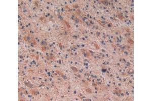 Used in DAB staining on fromalin fixed paraffin- embedded glioma tissue (Reelin Antikörper  (AA 26-190))