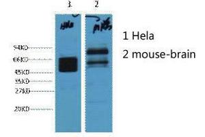Western Blot (WB) analysis of 1) HeLa, 2) Mouse Brain, diluted at 1:4000.