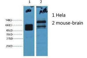 Western Blot (WB) analysis of 1) HeLa, 2) Mouse Brain, diluted at 1:4000. (KRT8 Antikörper)