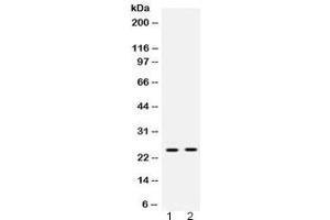 Western blot testing of 1) rat liver and 2) human placenta lysate with HMGB2 antibody at 0. (HMGB2 Antikörper)