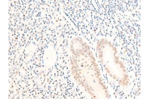 Immunohistochemistry (IHC) image for anti-Myc Proto-Oncogene protein (MYC) (pSer62) antibody (ABIN6255431)
