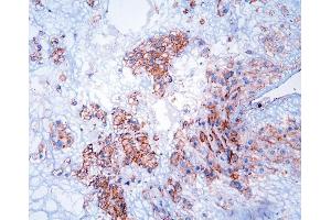 IHC analysis of GNB1 using anti-GNB1 antibody (ABIN4886607).