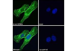 Immunofluorescence (IF) image for anti-Sodium Channel, Voltage-Gated, Type V, alpha Subunit (SCN5A) (Internal Region) antibody (ABIN185467)