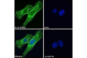 ABIN185467 Immunofluorescence analysis of paraformaldehyde fixed U2OS cells, permeabilized with 0.