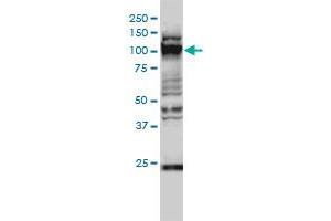 GTF3C2 monoclonal antibody (M01), clone 1C6-2B8 Western Blot analysis of GTF3C2 expression in Hela S3 NE .