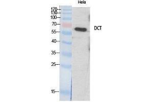 Western Blotting (WB) image for anti-Dopachrome Tautomerase (DCT) (Internal Region) antibody (ABIN3177806) (DCT Antikörper  (Internal Region))