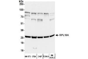 Western Blotting (WB) image for anti-Ribosomal Protein L10a (RPL10A) (AA 50-100) antibody (ABIN7450674) (RPL10A Antikörper  (AA 50-100))