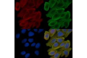 ABIN6258746 and ABIN6273920 staining Hela cells(30 min of UV treatment) by IF/ICC. (FZD10 Antikörper  (Internal Region))