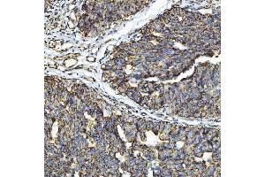 IHC analysis of GPCR RDC1/CXCR-7/ACKR3 using anti-GPCR RDC1/CXCR-7/ACKR3 antibody (ABIN7602889).