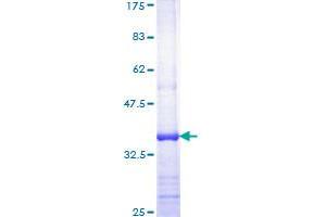 ZAP70 Protein (AA 397-493) (GST tag)